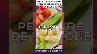 Le peroxyde de benzoyle pour éliminer lacné et les boutons [upl. by Layol]