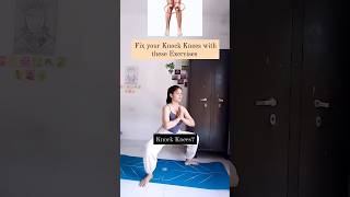 Knock Knees Exercises ✅ knockknees kneepainexercises kneepain yoga [upl. by Saks81]