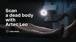 3D scanning a dead body with Artec Leo [upl. by Imik255]