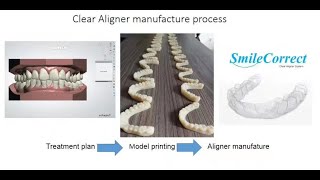 Clear Aligner Fabrication Whole Procedure [upl. by Adlesirg]