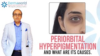 Periorbital Hyperpigmentation and what are its causes  Dr Rohit Batra explains [upl. by Sherill]