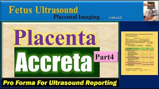 Fetus Ultrasound Placenta Accreta Part4 [upl. by Van]