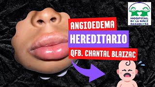 ANGIOEDEMA HEREDITARIO [upl. by Meelak449]