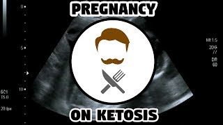 Keto Guide  Can you do KETO whilst PREGNANT [upl. by Hutton]