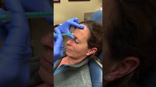 Quick Dysport Treatment at YPS dysport botox injection [upl. by Annola]