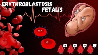 228 Erythroblastosis Foetalis  Maternal Foetal Rh Incompatibility  Class 12  Biology [upl. by Ahsinid]