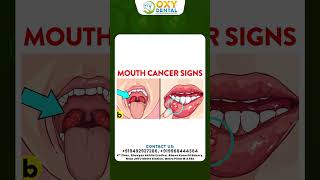 What is Mouth Cancer  Best Hospital In Hyderabad  Early Signs  Symptoms  Treatment  Oxy Dental [upl. by Eltsyek]