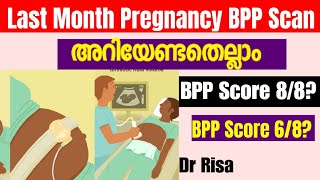 9 month Pregnancy ScanLast Month Pregnancy ScanWhat is BPP score [upl. by Llerref90]