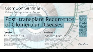 Post transplant Recurrence of Glomerular Diseases [upl. by Bria]