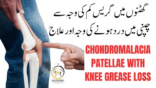 Best Exercise for Chondromalacia Patella  Jumpers Knee  Runners Knee Pain  Patellar Tendinitis [upl. by Sillek]