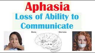 Aphasia  Types Broca’s Wernicke’s Global Causes Signs amp Symptoms Diagnosis Treatment [upl. by Deina]