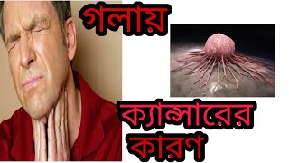 গলার ক্যান্সারের এইসব লক্ষণ অবহেলা করবেন না ভুলেও [upl. by Oisorbma]