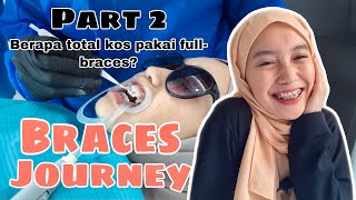 BRACES JOURNEY Part 2  Kos pasang full braces ni mahal ke [upl. by Narud]