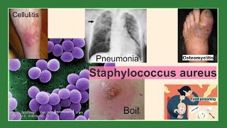 Staphylococcus aureus [upl. by Tolmach324]