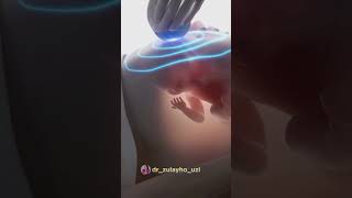 20 haftalikkacha boʻlgan homiladorlikda eng xavfli beshta belgi📌shortvideo pregnant health baby [upl. by Belamy]