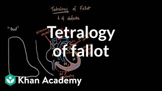 Tetralogy of fallot  Circulatory System and Disease  NCLEXRN  Khan Academy [upl. by Nada]