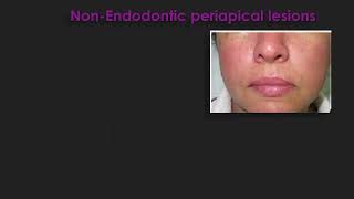 Periapical Neoplastic Lesions Prof Rania Othman [upl. by Adiazteb]