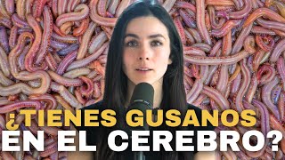 Un GUSANO en el CEREBRO Los peligrosos PARÁSITOS cerebrales [upl. by Rafaelia792]