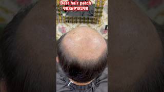 Best hair patch in KolkataBest hair cutting salon in Kolkatahairextensions viralreelstrending [upl. by Nadiya999]