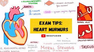 How to remember heart murmurs  Mnemonics Diagrams amp More  MedStudier [upl. by Fonzie637]