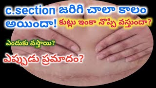 c section stitches pain reasons in teluguafter delivery mother care [upl. by Colet]