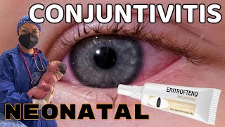 Conjuntivitis Neonatal Prevención con Eritromicina USMLE Pearls [upl. by Bremble]