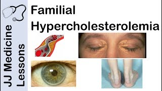 Familial Hypercholesterolemia  Genetics Pathophysiology Symptoms and Treatment [upl. by Sirois]