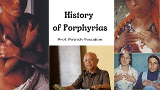 History of porphyrias [upl. by Wilmar]