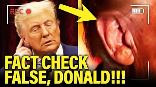 Trump SO CALLED EAR INJURY Claim BACKFIRES in His FACE [upl. by Odraude]