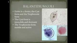 Parasitology Balantidiasis Part 2 [upl. by Feenah]