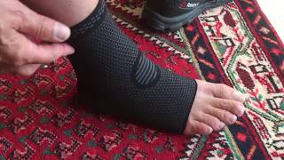 My trimalleolar fracture ORIF surgery and recovery as it happens Pt 3 [upl. by Ailemrac564]