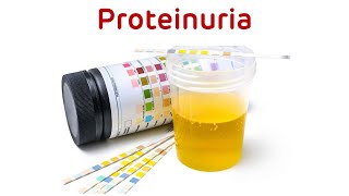 Proteinuria Protein In Urine  Proteinuria  Definition Types And Causes [upl. by Cinomod]