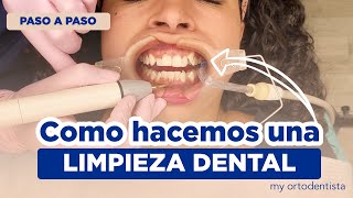 COMO SE HACE UNA LIMPIEZA DENTAL  el tratamiento que te hará ahorrar mucho dinero [upl. by Trilby]