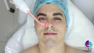 LIMPIEZA FACIAL HOMBRE Bucaramanga  Tratamiento facial paso a paso [upl. by Asille586]