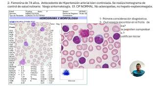 TALLER INTERPRETANDO HEMOGRAMAS EN LEUCEMIAS AGUDAS Y CRÓNICAS [upl. by Yunick181]