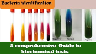 Identify Bacteria FAST with this Biochemical Test Microbiology [upl. by Centonze]