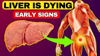 6 Weird Signs That You Have Liver Damage  HealthQuest [upl. by Aivil]