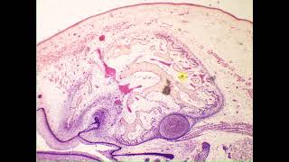 Cancellous spongy bone Pig Embryo snout [upl. by Ares]