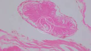 Schistosoma mansoni Sporocyst with Haematoxylin and Eosin HampE stain [upl. by Acinahs136]