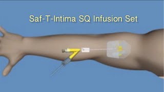 How to Insert SafTIntima™ SQ Infusion Set [upl. by Etteloiv]