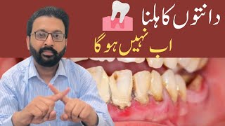 LOOSE TEETH Treatment Home Remedies [upl. by Cyrille563]