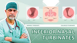 Inferior Nasal Turbinates Function Issues and Treatments Explained Dr Major Rajesh Bhardwaj [upl. by Martres]