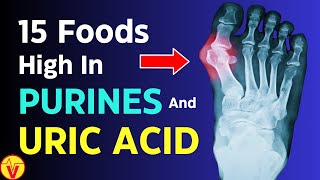 15 Foods HIGH in Purines and Uric Acid  Uric Acid Foods to Avoid  VisitJoy [upl. by Abbe]