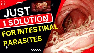 Dont Ignore These Early Symptoms of Intestinal Worms  Just 1 Solution for For Intestinal Parasites [upl. by Aseen]