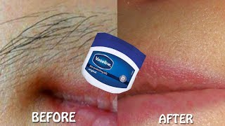 How to use vaseline for hair removal  Vaseline for hair  Vaseline for remove hair permanently [upl. by Raddi]