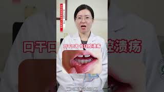 经常上火怎么办？试试一味中药泡水喝 火 上火 中医养生 健康科普 硬核健康科普行动 [upl. by Di]