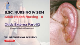 Otitis Externa Part2  Diagnosis Finding Management  Valinee Nursing Academy [upl. by Tillio379]