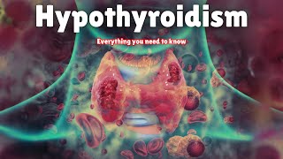 Hypothyroidism  Symptoms Causes Treatment amp Medication [upl. by Kial]