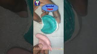 Making Video  Dental Special Tray  Maxillary Dentulous Cast  Tamil Dental Lab  completedenture [upl. by Gunter]