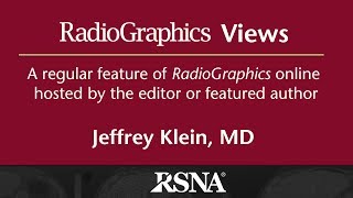 Contrastenhanced US Approach to the Diagnosis of Focal Liver Masses [upl. by Cassell932]